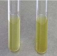 乳糖发酵对照培养基